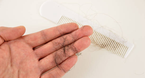 Read more about the article 6 Proven Ways to Control Hair Fall Naturally (Beginner-Friendly Guide)